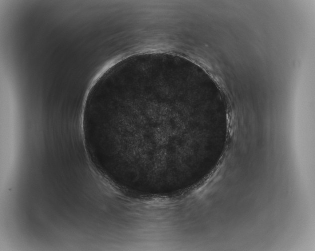 X0000113560196200909251105