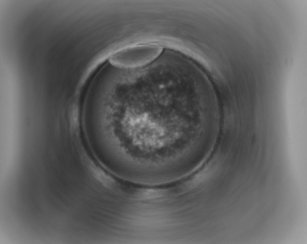 X0000113561506200909251048