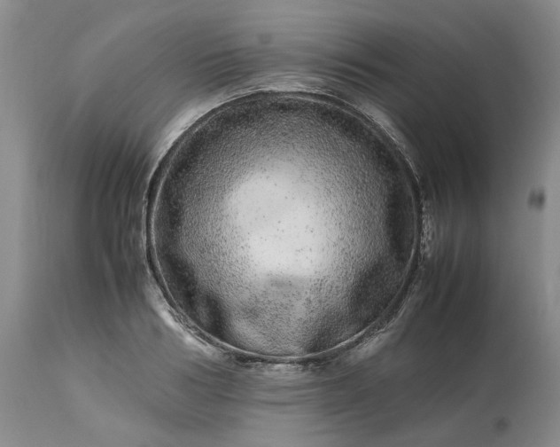 X0000113560986200910021551
