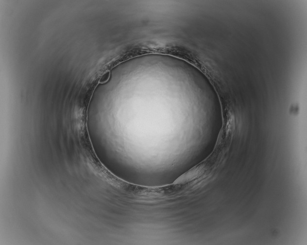 X0000113561156200910021548