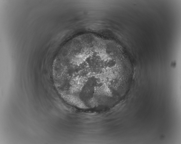 X0000113561009200910091410