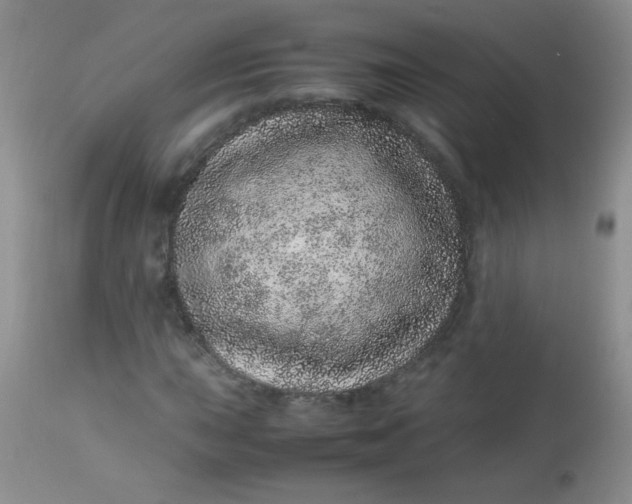 X0000113561015200910091410