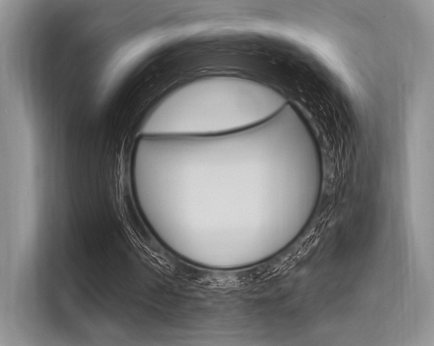X0000113570194200909181006
