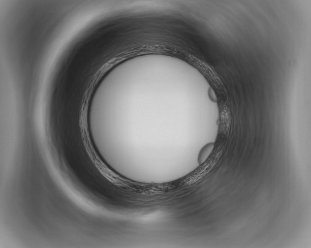 X0000113570765200909180959