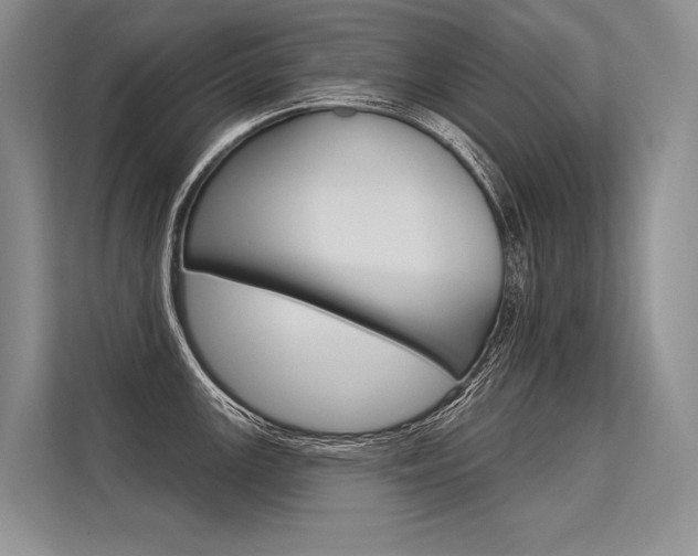 X0000113571147200909180954