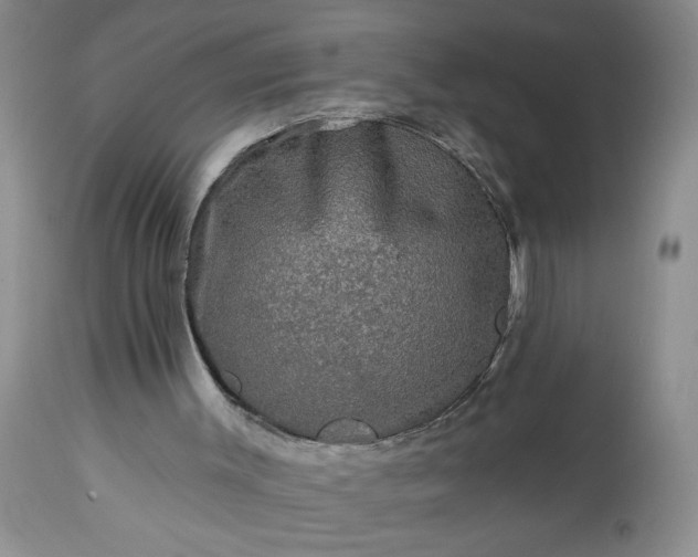 X0000113570003200910021640