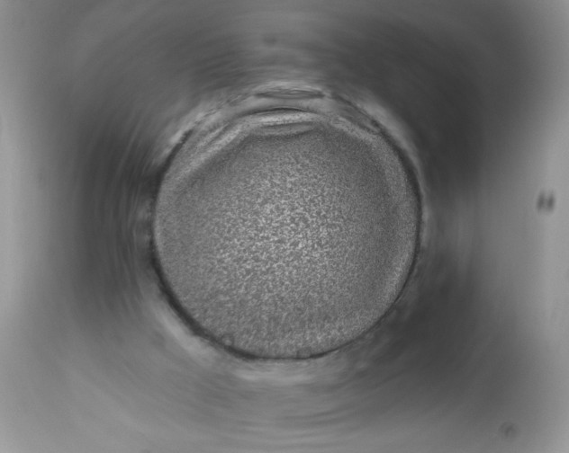 X0000113570009200910091449