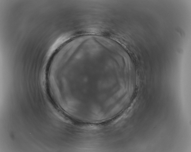 X0000113570198200910161525