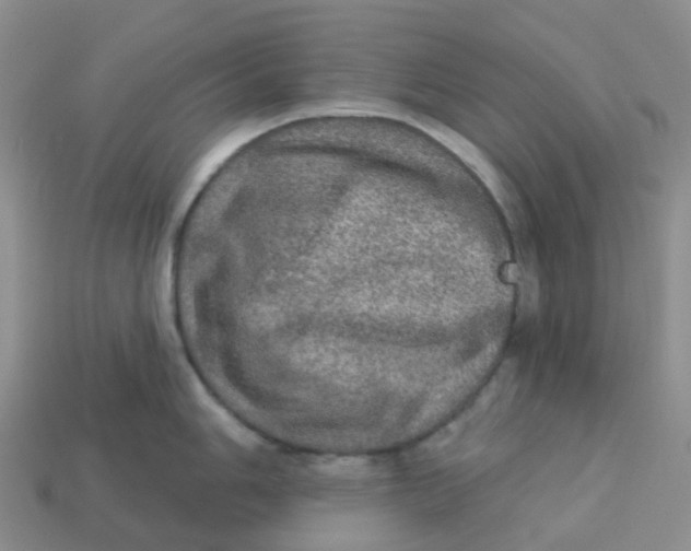 X0000113571006200910161514