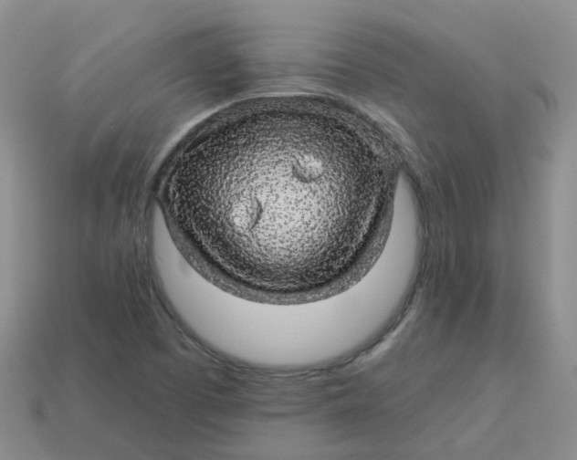 X0000113571457200910161508