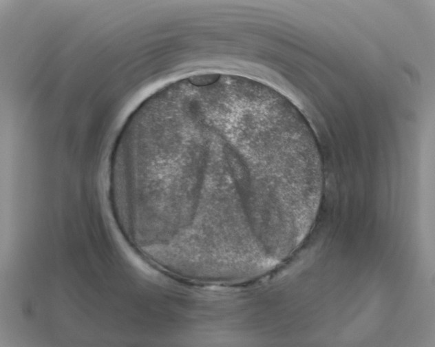 X0000113571523200910161507