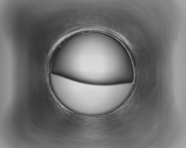 X0000113581504200909181009