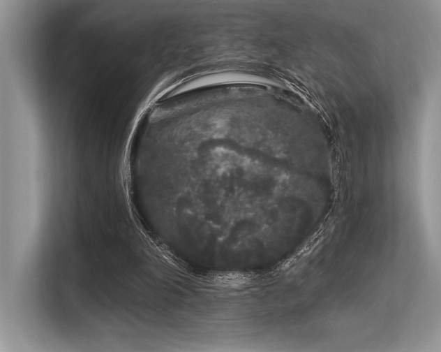 X0000113580198200909181314