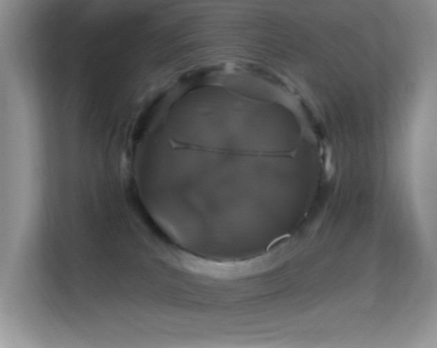 X0000113580039200909251204