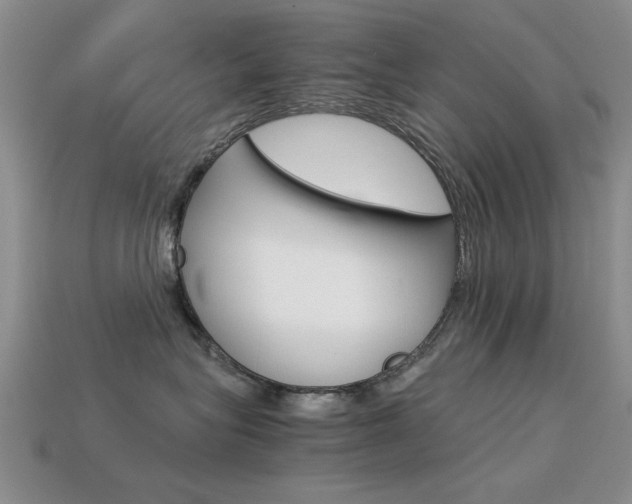 X0000113590575200909181050