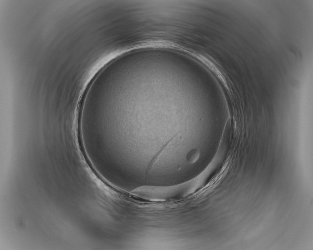 X0000113591438200909181322