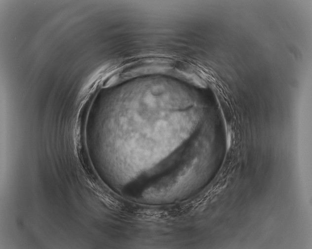 X0000113590339200909251140