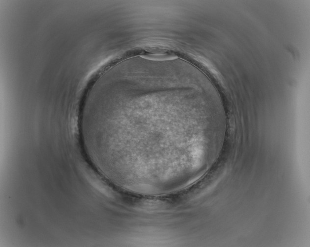 X0000113590399200910091504