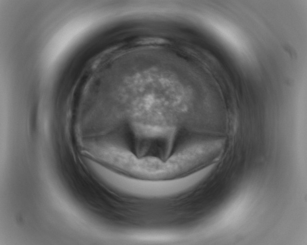 X0000113591151200910091454