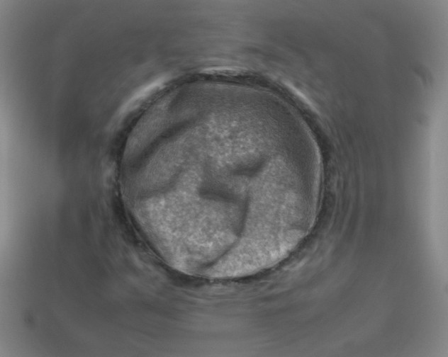 X0000113591351200910091451