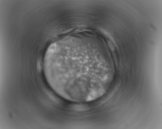 X0000113590069200910161852