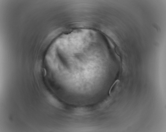 X0000113590105200910161852