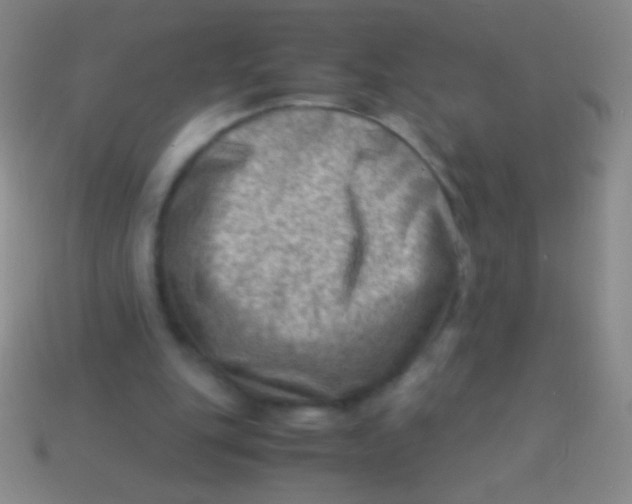 X0000113590151200910161850