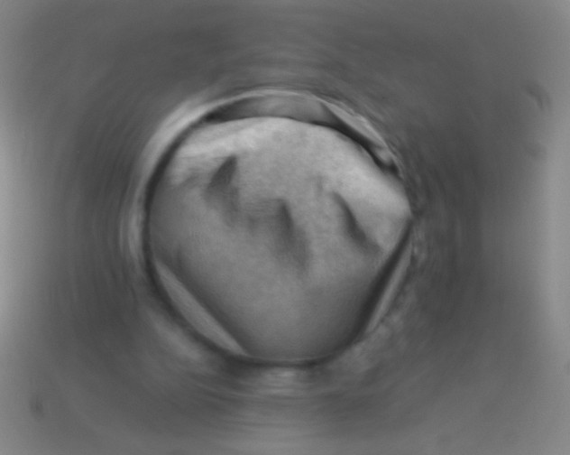 X0000113590152200910161850