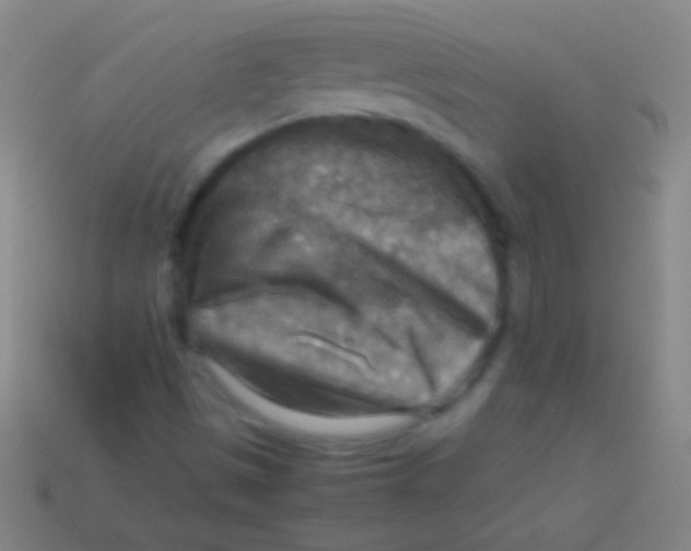 X0000113591497200910161831