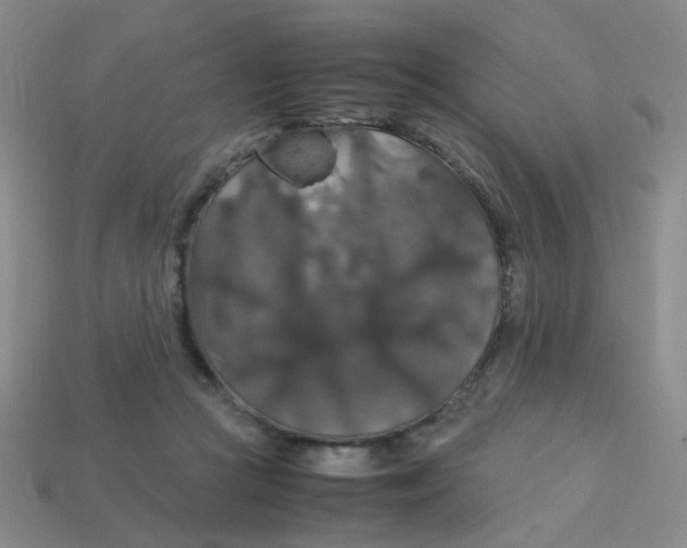 X0000113600361200910091525