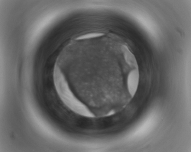 X0000113600383200910161911