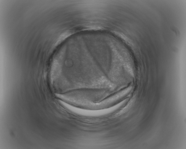 X0000113601257200910161857