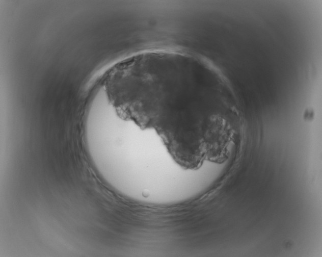 X0000113611215200909181043