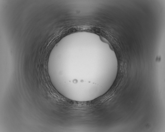 X0000113611393200909181040