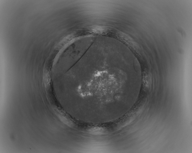 X0000113610593200909181420