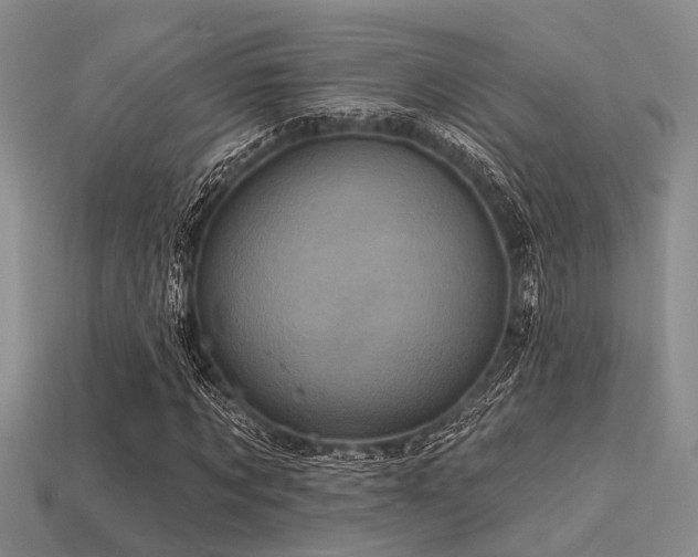 X0000113610869200909181417