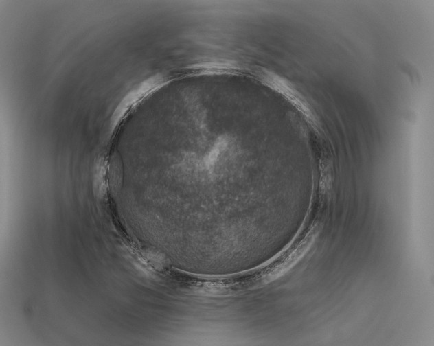 X0000113611357200909181410