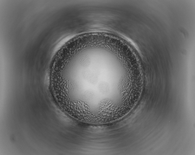 X0000113611415200909181410