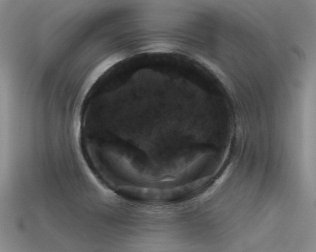 X0000113611418200909181410