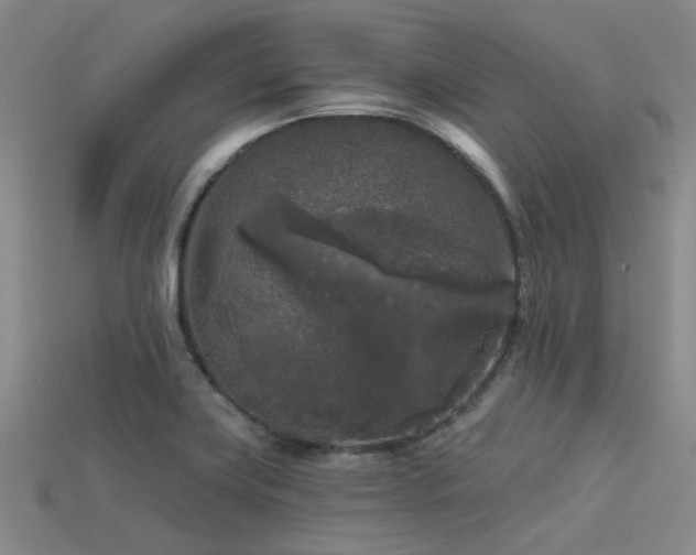 X0000113611419200909181410