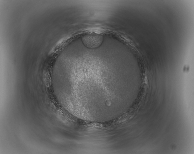 X0000113611446200909251131