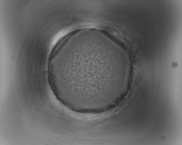 X0000113610006200910021815