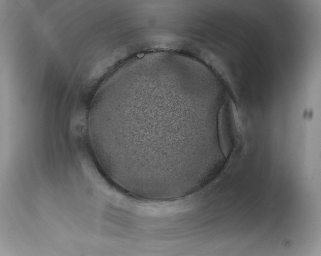 X0000113610017200910021814