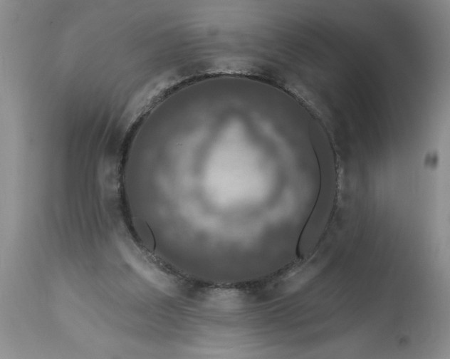 X0000113610203200910021812