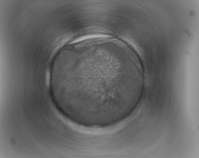 X0000113610014200910091551