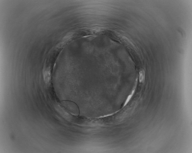 X0000113611011200910091537