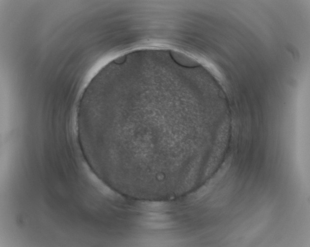 X0000113611382200910091532