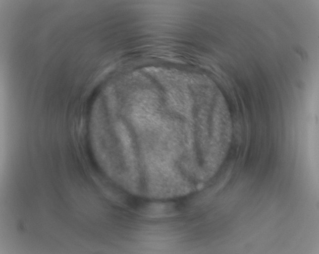 X0000113610375200910161935