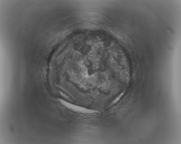 X0000113611397200910161918