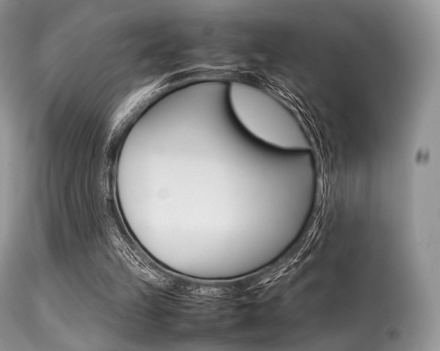 X0000113620149200909181124